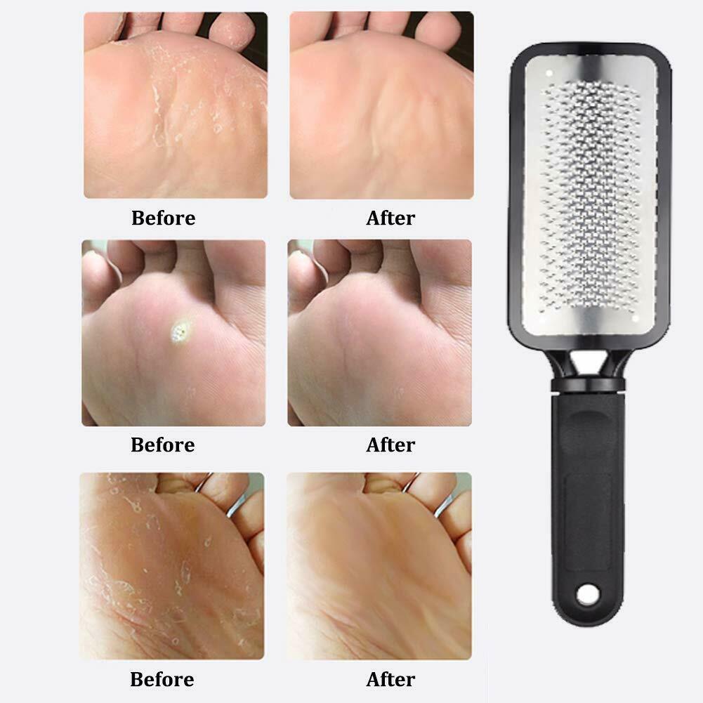 Professional Foot Callus Remover File Rasp Scraper Cracked Pedicure Rough Tool